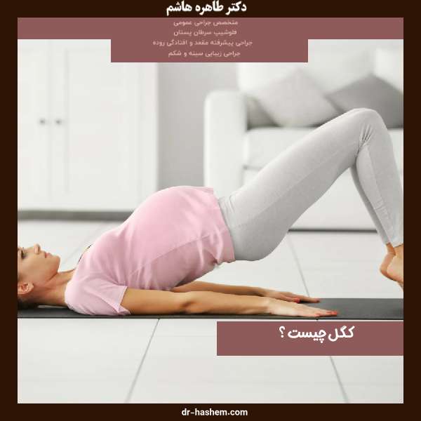 کگل در بارداری - دکتر هاشم -dr-hashem.com