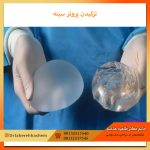 ترکیدن-پروتز-سینه