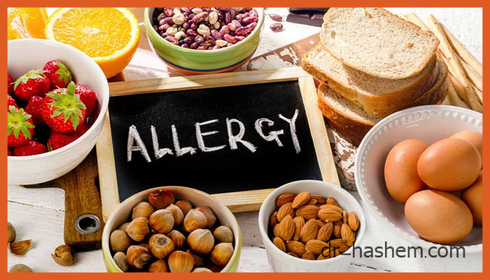علائم و نشانه های آلرژی غذایی 