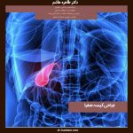 جراحی کیسه صفرا