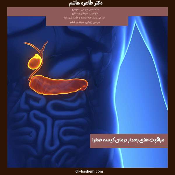 مدت استراحت بعد از عمل کیسه صفرا