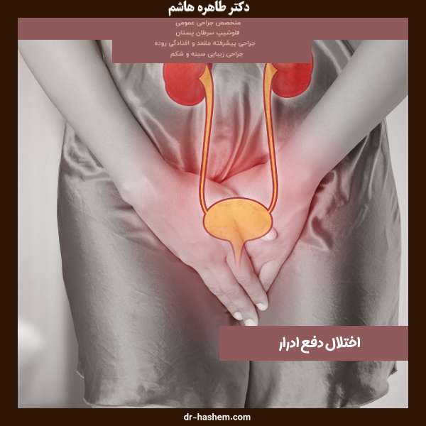 اختلال دفع ادرار