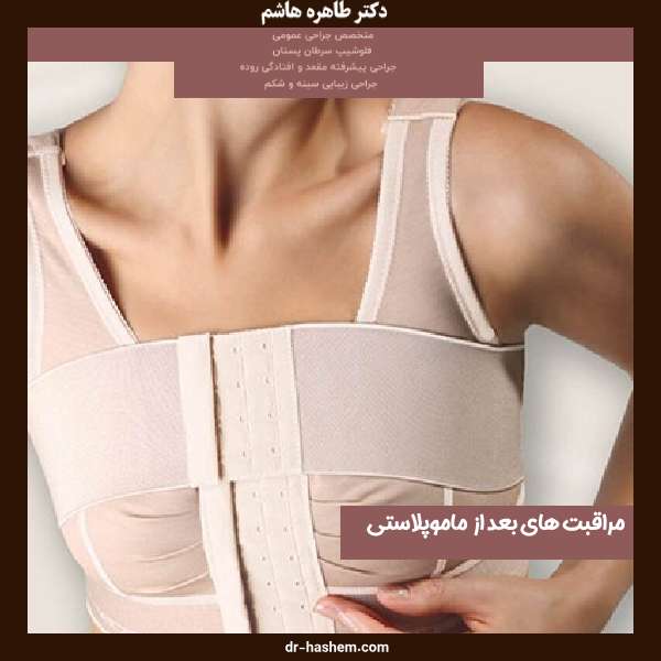 مراقبت های بعد از ماموپلاستی
