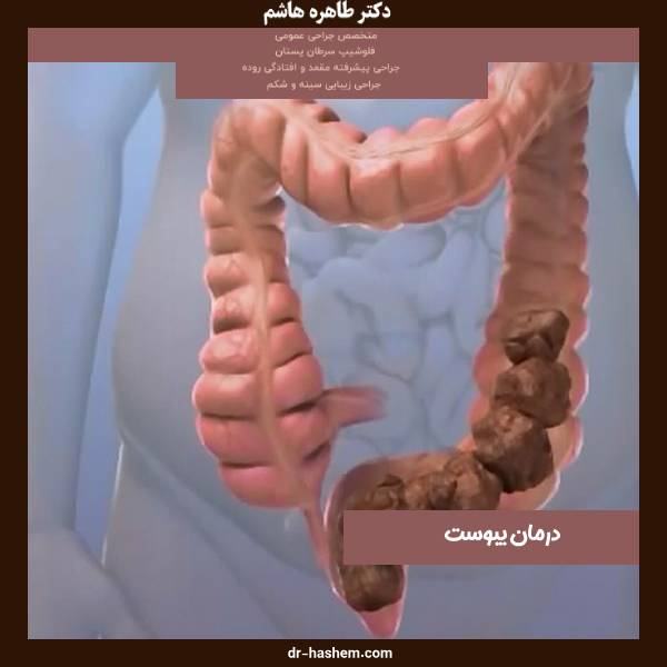 عکس علائم یبوست