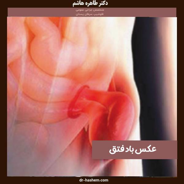 عکس باد فتق