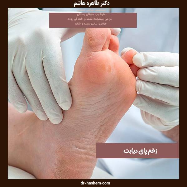 عکس زخم پای دیابتی