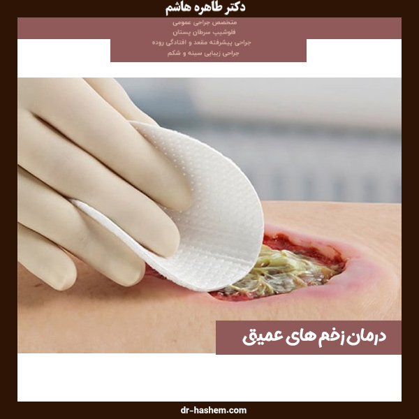 درمان زخم های عمیق
