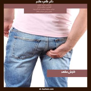 خارش مقعد - دکتر طاهره هاشم -dr-hashem.com
