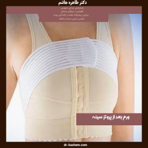 ورم بعد از پروتز سینه - دکتر طاهره هاشم - dr-hashem.com