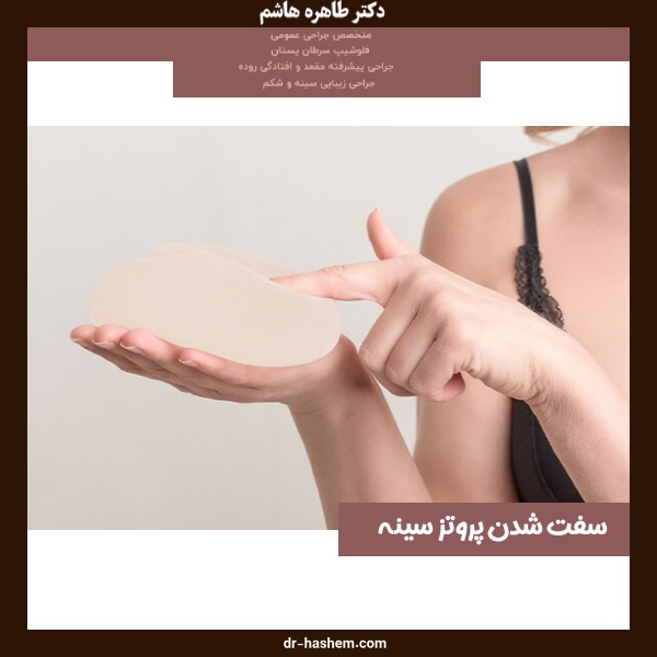 سفت شدن پروتز سینه