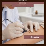 برداشتن خال