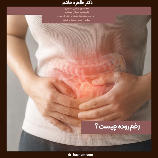 زخم روده چیست؟